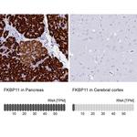 FKBP11 Antibody in Immunohistochemistry (IHC)