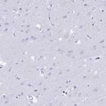 FKBP11 Antibody in Immunohistochemistry (IHC)