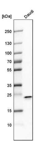 FKBP11 Antibody in Western Blot (WB)