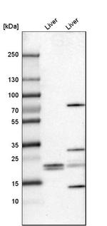 FKBP11 Antibody in Western Blot (WB)