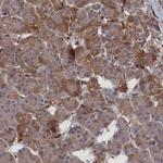 LYPLA3 Antibody in Immunohistochemistry (IHC)