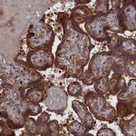 LYPLA3 Antibody in Immunohistochemistry (IHC)