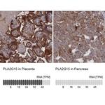 LYPLA3 Antibody