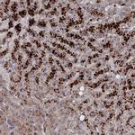 LYPLA3 Antibody in Immunohistochemistry (IHC)