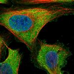 ZNF598 Antibody in Immunocytochemistry (ICC/IF)