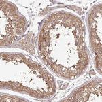 JIP3 Antibody in Immunohistochemistry (Paraffin) (IHC (P))