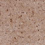 AKTIP Antibody in Immunohistochemistry (Paraffin) (IHC (P))