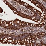 AKTIP Antibody in Immunohistochemistry (Paraffin) (IHC (P))