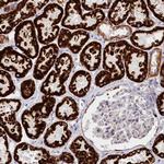 AKTIP Antibody in Immunohistochemistry (Paraffin) (IHC (P))