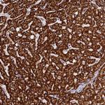 AKTIP Antibody in Immunohistochemistry (Paraffin) (IHC (P))