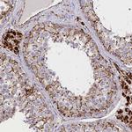 AKTIP Antibody in Immunohistochemistry (Paraffin) (IHC (P))