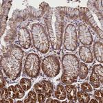 IFT122 Antibody in Immunohistochemistry (Paraffin) (IHC (P))