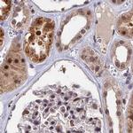 POLR2C Antibody in Immunohistochemistry (IHC)