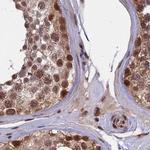 POLR2C Antibody in Immunohistochemistry (IHC)