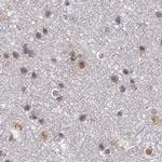 POLR2C Antibody in Immunohistochemistry (IHC)