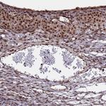 POLR2C Antibody in Immunohistochemistry (IHC)