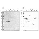 POLR2C Antibody in Western Blot (WB)