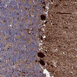 PMSCL1 Antibody in Immunohistochemistry (Paraffin) (IHC (P))