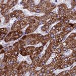 UQCRFS1 Antibody in Immunohistochemistry (Paraffin) (IHC (P))