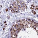 UQCRFS1 Antibody in Immunohistochemistry (Paraffin) (IHC (P))