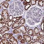 UQCRFS1 Antibody in Immunohistochemistry (IHC)