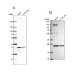 UQCRFS1 Antibody in Western Blot (WB)