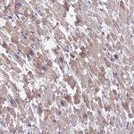 MVB12A Antibody in Immunohistochemistry (Paraffin) (IHC (P))