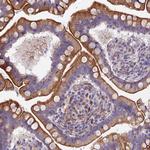 MVB12A Antibody in Immunohistochemistry (Paraffin) (IHC (P))