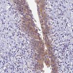 MVB12A Antibody in Immunohistochemistry (Paraffin) (IHC (P))