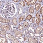 ZNF598 Antibody in Immunohistochemistry (Paraffin) (IHC (P))