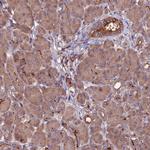 ZNF598 Antibody in Immunohistochemistry (Paraffin) (IHC (P))