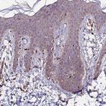 ZNF598 Antibody in Immunohistochemistry (Paraffin) (IHC (P))