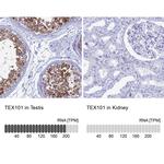 TEX101 Antibody in Immunohistochemistry (IHC)