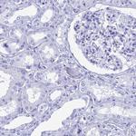 TEX101 Antibody in Immunohistochemistry (IHC)