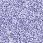 TEX101 Antibody in Immunohistochemistry (IHC)