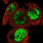 F1A alpha Antibody in Immunocytochemistry (ICC/IF)