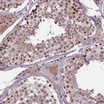 F1A alpha Antibody in Immunohistochemistry (IHC)