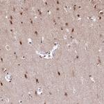 F1A alpha Antibody in Immunohistochemistry (Paraffin) (IHC (P))