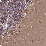 DOHH Antibody in Immunohistochemistry (Paraffin) (IHC (P))