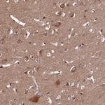 DOHH Antibody in Immunohistochemistry (Paraffin) (IHC (P))