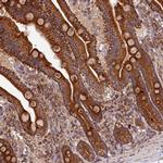 DOHH Antibody in Immunohistochemistry (Paraffin) (IHC (P))