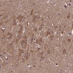 DOHH Antibody in Immunohistochemistry (Paraffin) (IHC (P))