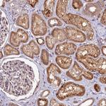 DOHH Antibody in Immunohistochemistry (Paraffin) (IHC (P))