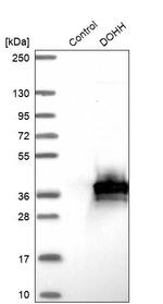 DOHH Antibody in Western Blot (WB)