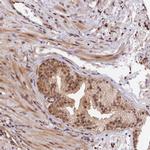 IMPACT Antibody in Immunohistochemistry (IHC)