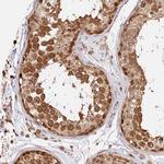 IMPACT Antibody in Immunohistochemistry (IHC)