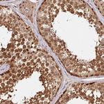 IMPACT Antibody in Immunohistochemistry (IHC)