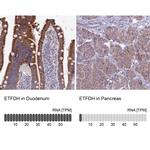 ETFDH Antibody in Immunohistochemistry (IHC)