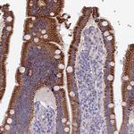 ETFDH Antibody in Immunohistochemistry (IHC)