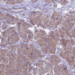 ETFDH Antibody in Immunohistochemistry (IHC)